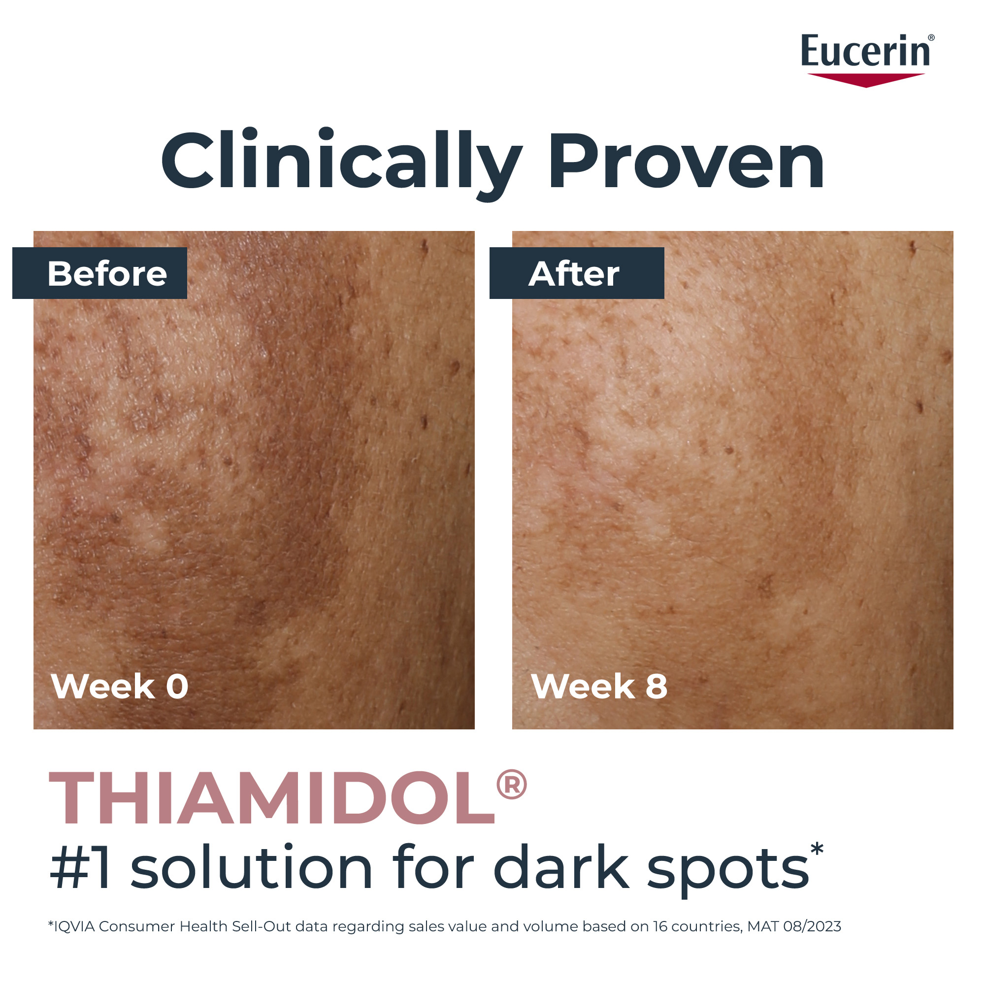 EUCERIN Even Pigment Perfector Skin Perfecting Serum 30ml - Image 4